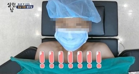 【公式】KBS「家事をする男たち2」、未成年者の“赤裸々すぎる”手術シーンの再視聴を中止