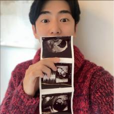 “9歳差カップル”俳優アン・ヨンジュン＆Venny、第1子妊娠を発表