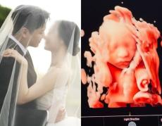 芸能界引退と同時に婚姻”「FTISLAND」出身ソン・スンヒョン、結婚から2