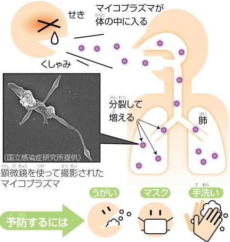 マイコプラズマ肺炎、患者数が過去最多…熱が下がった後も３～４週間せきが続くことも