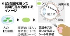 「黄斑円孔」のサル、ＥＳ細胞から作った網膜シート移植で視力改善…神戸アイセンター病院など